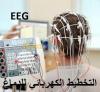 NEUROLOGUE  BEHIDJ EEG EMG الأعصاب