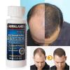 Minoxidil Kirkland 5% de USA