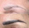 Détatouage sourcils sans laser