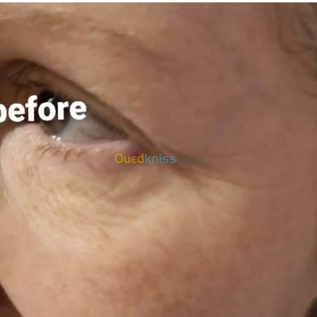 Sérum d'acide hyaluronique contour des yeux 