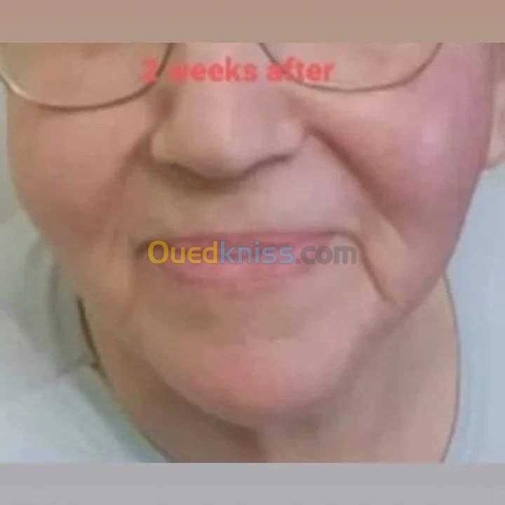 Sérum d'acide hyaluronique visage 