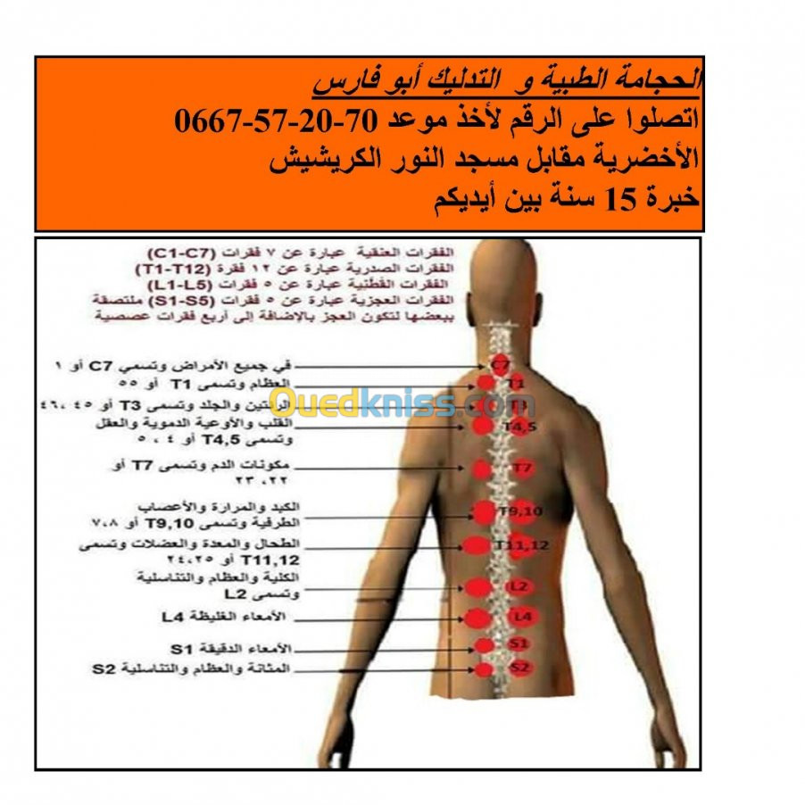 الحجامة الطبية النبوية أبو فارس