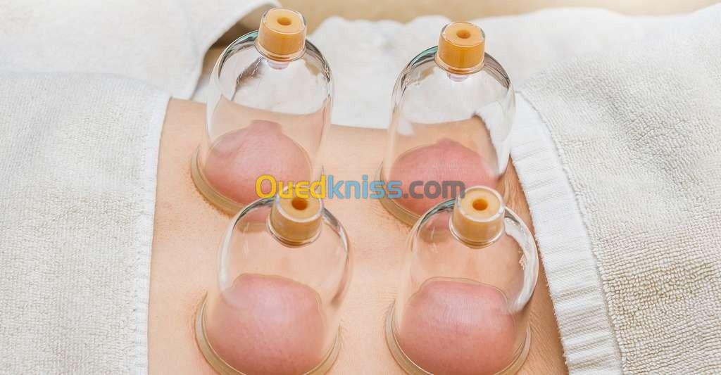 HIJAMA Médicale et Prophétique