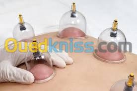 hijama حجامة