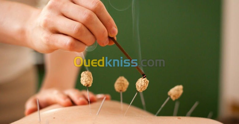 Hijama et acupuncture