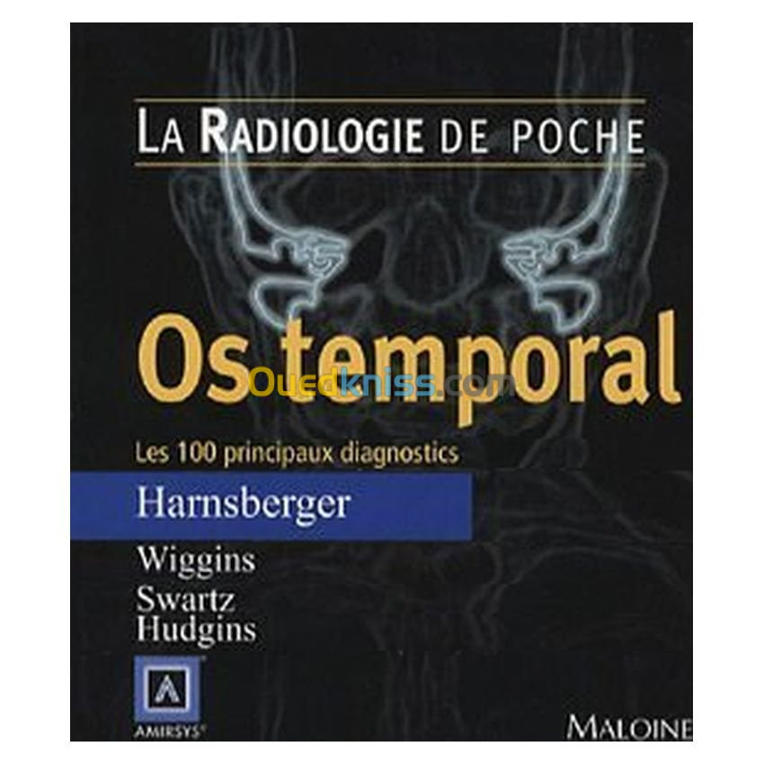 Os temporal: les 100 principaux diagnostics : Radiologie de Poche