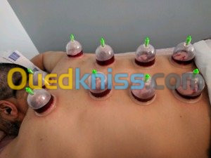 HIJAMA Médicale et Prophétique