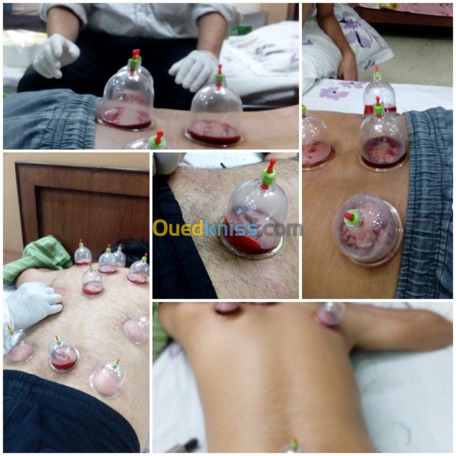 HIJAMA Médicale et Prophétique