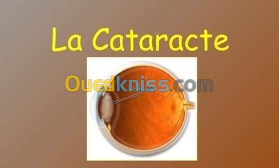 Implants pour chirurgie de cataracte 