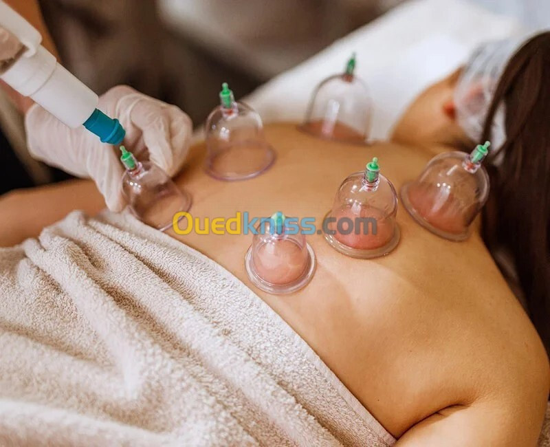 Hijama