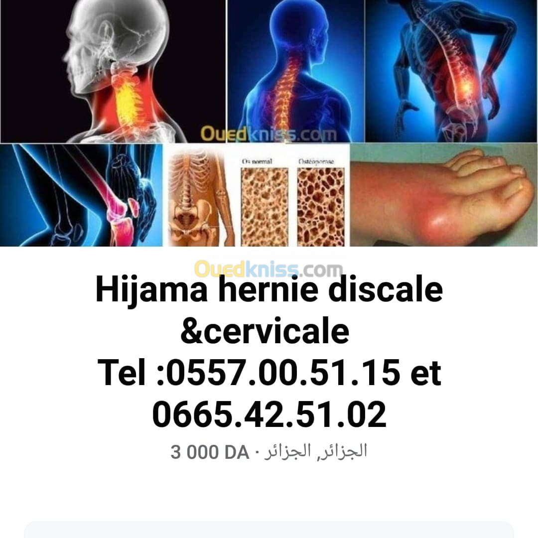 Hijama médical Acupuncture Hernie discale 