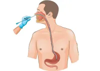 Sondage urinaire et sondage naso gastrique à domicile 