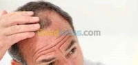 chute de cheveux chez l'homme