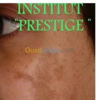 عنابة-الجزائر-تجميل-و-جمال-soins-esthÉtique