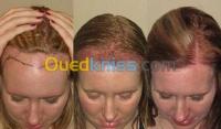 tiaret-alger-centre-algerie-esthétique-beauté-زراعة-الشعر-شعر-الراس-اللحية-الحواجب