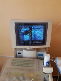 Echographe (ultra sondes )