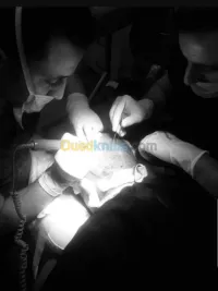 Implant capillaire 