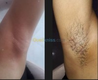 الجزائر-زرالدة-تجميل-و-جمال-Épilation