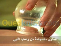 حجامة حديثة