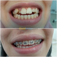 طب-و-صحة-orthodontie-odf-برج-الكيفان-الجزائر