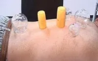 Hijama à domicile 