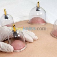 البليدة-أولاد-يعيش-الجزائر-طب-و-صحة-الحجامة-الوقائية