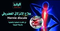 الجزائر-برج-البحري-طب-و-صحة-علاج-الإنزلاق-الغضروفي