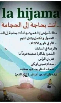 الحجامة 