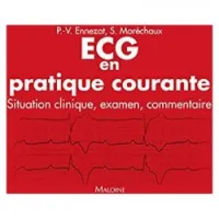 ECG en pratique courante