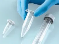 Consommables de laboratoires médicaux