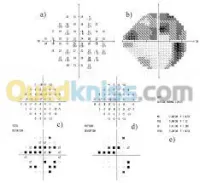Champ visuel Automatique 