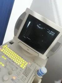 Échographe ALOKA 1400