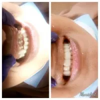 Soins dentaire 