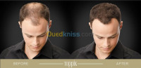 cheveux-promo-pack-toppik-مثبت-بخاخ-alger-centre-el-biar-algerie