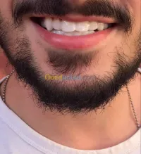 Snap on smaile