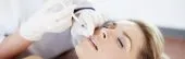 Epilation laser - Traitement des rides