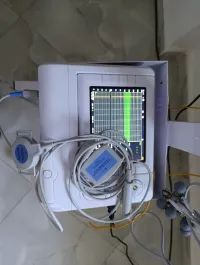 Fetal monitor contec