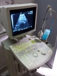 Echographe ALOKA SSD-1000