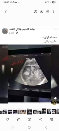 طبي-versana-essential-المرسى-الشلف-الجزائر