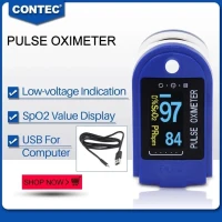 Oxymetre De Pouls Saturation avec enregistrement 24H et logiciel pc marque contec
