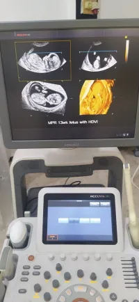 Echographe 