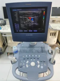 Echographe SIEMENS ACUSON X150 Doppler Couleur avec 2 sondes