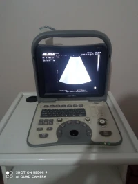 Echographe modele jejiga PN5 