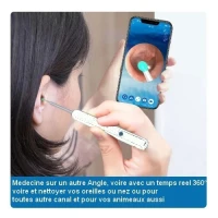 Endoscope / Canuscope / Otoscope Wifi قلم المنظار الاسلكي وايفاي