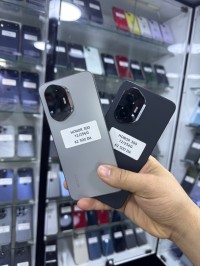 هواتف-ذكية-honor-300-12256g-باب-الزوار-الجزائر
