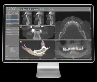 coDiagnostiX v10.9 (2025) thumbnail 2