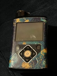 آخر-جهاز-بنكرياس-اصطناعي-medtronic-minimed-بومرداس-الجزائر