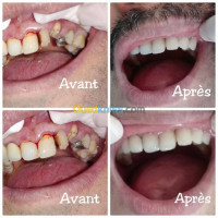 medecine-sante-chirurgien-dentiste-odf-ain-benian-alger-algerie