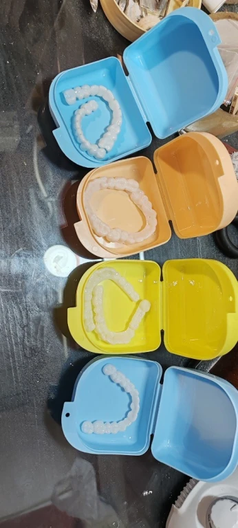 snap on smile sur mesure (l'original)