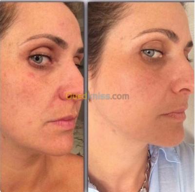 alger-centre-algerie-autre-luminesce-flawless-skin-brightener